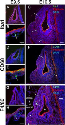 Early Development of Resident Macrophages in the Mouse Cochlea Depends on Yolk Sac Hematopoiesis